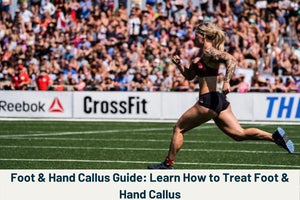 how to prevent calluses from ripping and bleeding