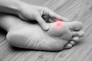 calluses on feet for athletes
