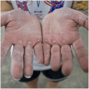 Ensure you get the best callous care solution in the market. You need callus shaving, callus soothing and moisturizing