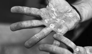callus-remover