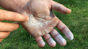 How to manage your hand callus