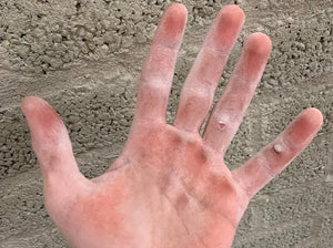 Callus management for rock climbing