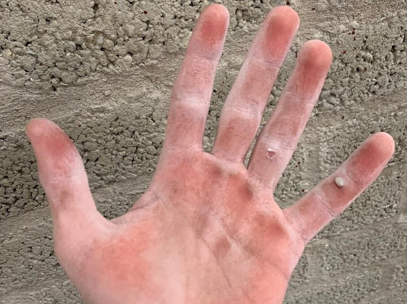 How to Heal Your Hands from Rock Climbing – Callus Performance