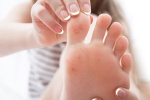 calluses on foot can be beneficial until they rip or bleed. learn how to care of them proactively