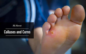 Ensure you get the best callous care solution in the market. You need callus shaving, callus soothing and moisturizing