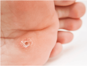 Internal corn on foot shop