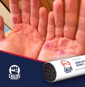 Professional Rowers Calluses Managing Calluses in Rock Climbing - Callus Performance